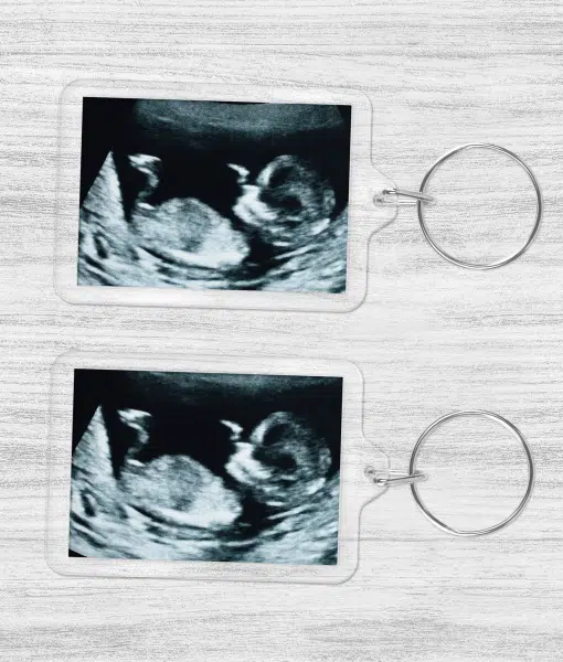 Baby Scan Photo Keyring