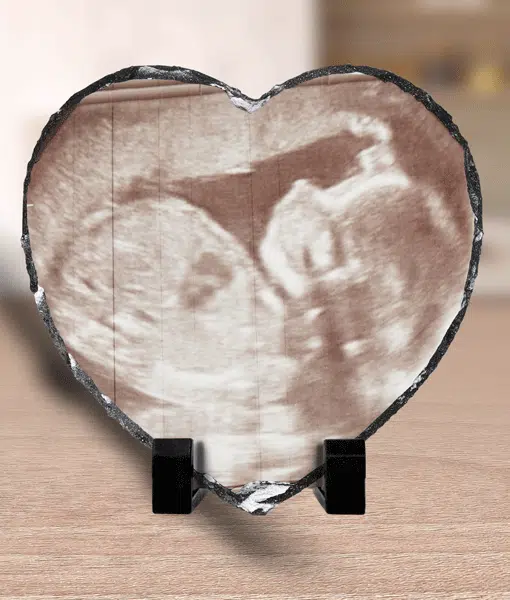 Personalised Baby Scan Photo Slate Keepsake Gift Baby Shower Gifts