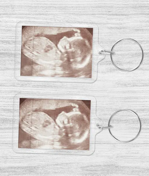 Baby Scan Photo Keyring